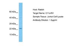 C11orf91 Rabbit anti-Human, Polyclonal, Novus Biologicals 0.1 mL | Buy Online | Novus Biologicals | Fisher Scientific
